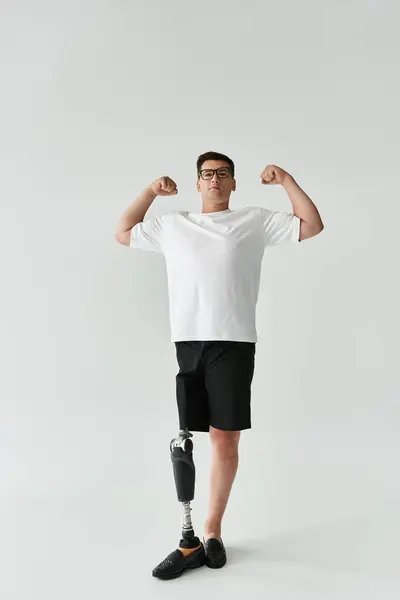 Young man with a prosthetic leg proudly flexes his muscles in a bright indoor space. — Stock Photo
