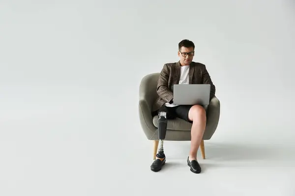 Handsome young man using a laptop with a prosthetic leg while sitting comfortably in a chair. — Stock Photo