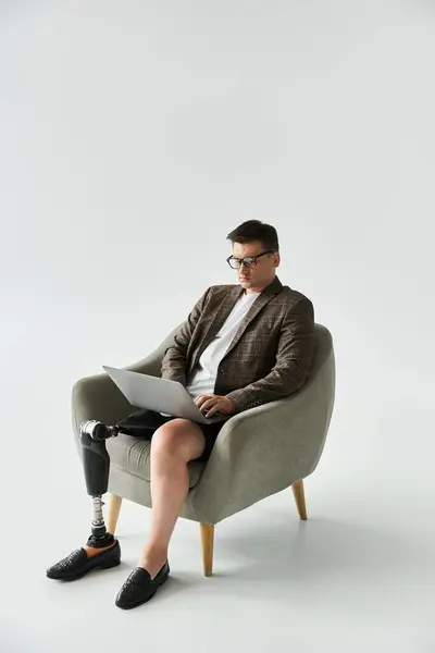 Handsome young man using a laptop while sitting in an armchair with a prosthetic leg. — Stock Photo