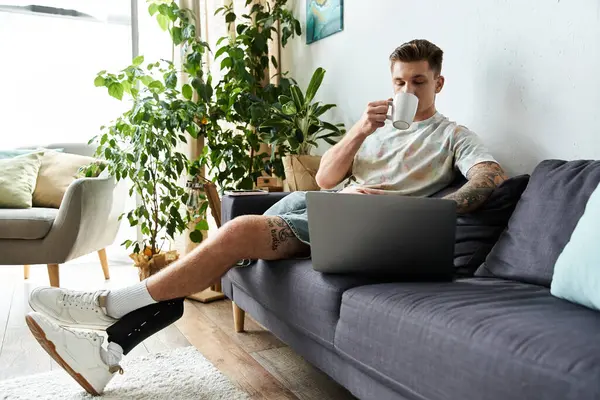Joven guapo descansa en el sofá con el ordenador portátil, sorbiendo café, mostrando su pierna protésica. - foto de stock