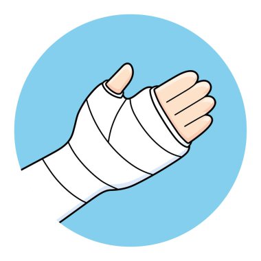 Ortopedik alçıyla kırık kol.