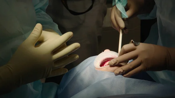 Δύο Επαγγελματίες Γιατροί Κάνουν Οδοντιατρική Χειρουργική Τοποθετώντας Οδοντικά Εμφυτεύματα Στο — Φωτογραφία Αρχείου
