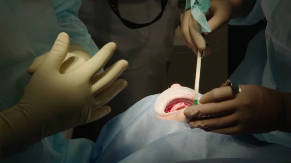 Dos Médicos Profesionales Realizan Una Cirugía Dental Colocando Implantes Dentales — Foto de Stock