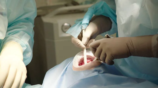 Δύο Επαγγελματίες Γιατροί Κάνουν Οδοντιατρική Χειρουργική Τοποθετώντας Οδοντικά Εμφυτεύματα Στο — Φωτογραφία Αρχείου