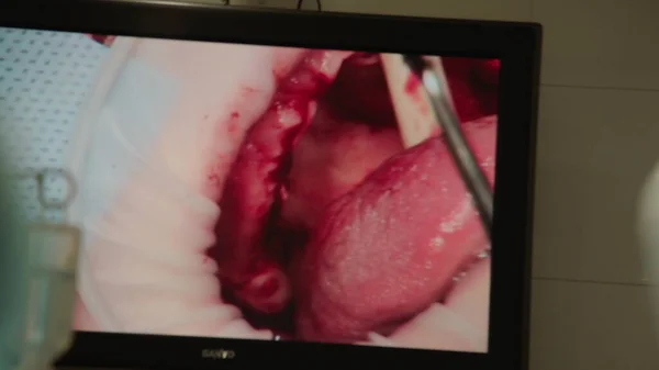 Operasi Medis Dan Gigi Pada Monitor Ruang Operasi Secara Real — Stok Foto