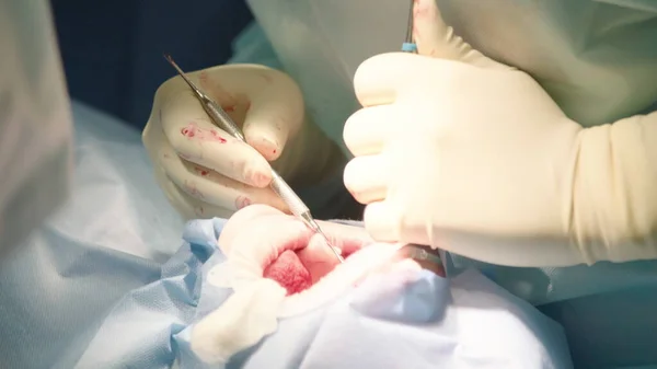 Primer Plano Médicos Atentos Atentos Que Realizan Cirugía Oral Hospital — Foto de Stock
