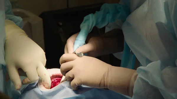 Dwóch Profesjonalnych Lekarzy Wykonuje Zabieg Stomatologiczny Wszczepiając Implanty Stomatologiczne Pacjentowi — Zdjęcie stockowe