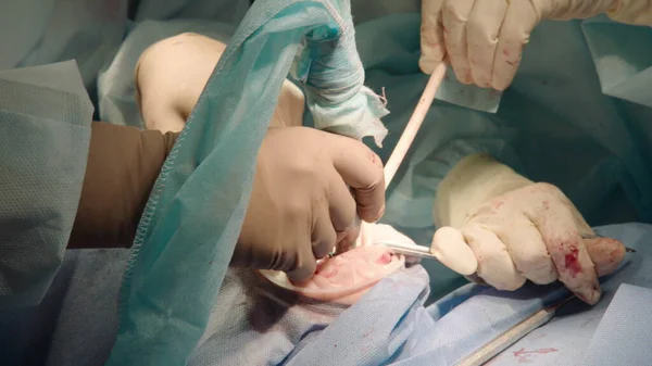 Nahaufnahme Aufmerksamer Aufmerksamer Ärzte Die Oralchirurgie Krankenhaus Durchführen Zahnärztliche Instrumente — Stockfoto