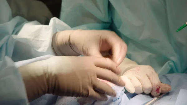 Hastanede Ağız Cerrahisi Yapan Özenli Doktorları Yakından Çek Diş Aletleri — Stok fotoğraf