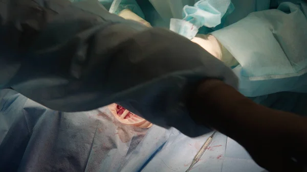 Процесс Стоматологической Хирургии Врачи Имплантируют Имплантаты — стоковое фото