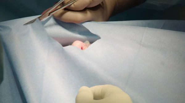 Close Cirurgião Dentista Realizando Uma Cirurgia Implante Dentário Numa Clínica — Fotografia de Stock