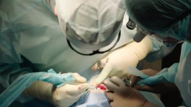 Diş cerrahisi süreci. Doktorlar diş implantı yerleştirir..