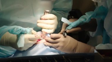 Hastanede ağız cerrahisi yapan özenli doktorları yakından çek. Diş aletleri. Diş sağlığı kliniği. Diş ameliyatı. Yavaş çekim.