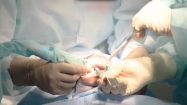  Hastanede ağız cerrahisi yapan özenli doktorları yakından çek. Diş aletleri. Diş sağlığı kliniği. Diş ameliyatı