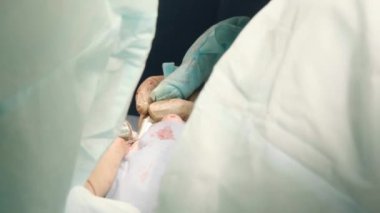 Hastanede ağız cerrahisi yapan özenli doktorları yakından çek. Diş aletleri. Diş sağlığı kliniği. Diş ameliyatı