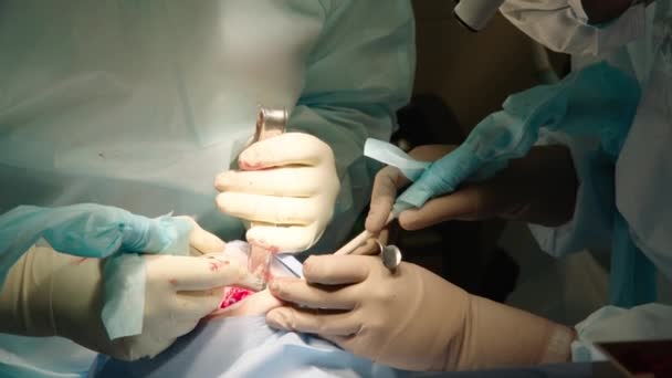 Κοντινό Πλάνο Περιποιητικών Γιατρών Που Κάνουν Στοματική Χειρουργική Στο Νοσοκομείο — Αρχείο Βίντεο
