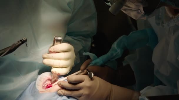 在医院进行口腔手术的专注专注的医生的特写镜头 牙科器械 牙科诊所牙科手术 慢动作 — 图库视频影像