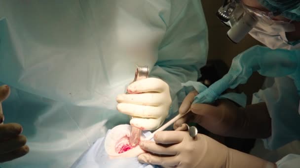 Detailní Záběr Pozorných Pozorných Lékařů Provádějících Orální Chirurgii Nemocnici Zubní — Stock video
