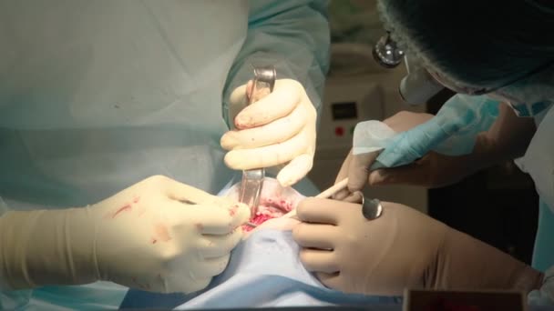 Gros Plan Sur Des Médecins Attentifs Attentifs Pratiquant Une Chirurgie — Video