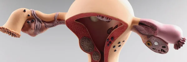 Primer Plano Del Modelo Anatómico Útero Ovarios Femeninos Órganos Reproductivos — Foto de Stock