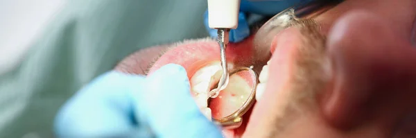 Närbild Person Besök Stomatologi Klinik Tand Fast Minska Smärta Tandläkare — Stockfoto