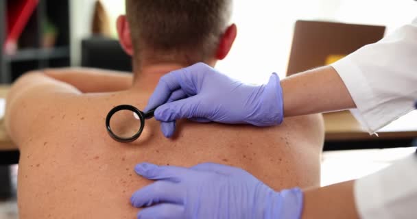 医生用放大镜检查男性患者的背部皮肤 皮肤镜检和痣及年龄点检查 — 图库视频影像