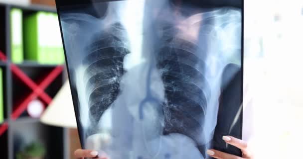 Docteur Examine Radiographie Des Poumons Clinique Pneumonie Bronchite Coronavirus Infection — Video