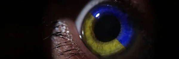 Female Eye Blue Yellow Iris Color Ukraine Flag Closeup Assistance — ストック写真