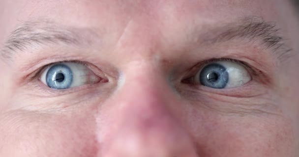 Man Blue Eyes Does Gymnastics Eyes Exercises Restoring Vision Eyes — Stock Video