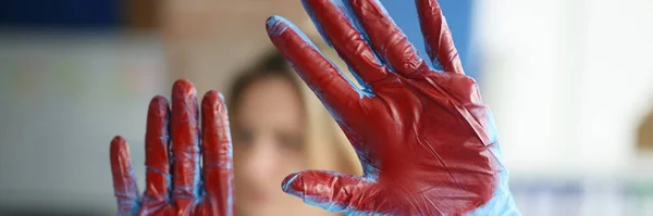 血淋淋的医生手在诊所的医疗手套 流血和停止流血的方法 — 图库照片