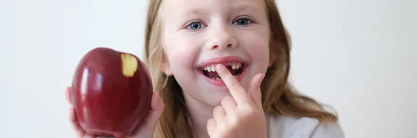 Leende Flicka Utan Tand Håller Äpple Pediatrisk Tandvård Och Förlust — Stockfoto