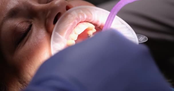 Пацієнтка Рефрактором Ротової Порожнини Під Час Лікування Стоматологічному Кабінеті Стоматологи — стокове відео