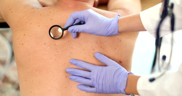 Dermatolog Bada Skórę Plecach Pacjenta Zbliżenie Dermoskopia Pieprzyków Raka Skóry — Wideo stockowe