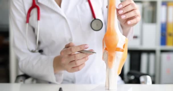 Médico Muestra Anatomía Estructura Articulación Rodilla Humana Esguince Esguince Concepto — Vídeo de stock