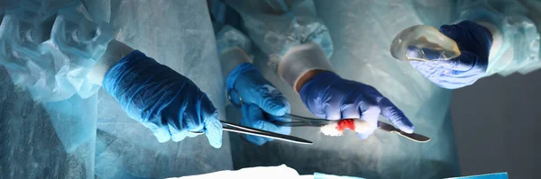 Zbliżenie Narzędzi Operacyjnych Implantów Klatki Piersiowej Sali Operacyjnej Proces Implantacji — Zdjęcie stockowe