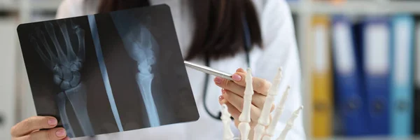 Close Traumatologist Uniform Examine Patient Scan Prepare Conclusion Medical Worker — Photo