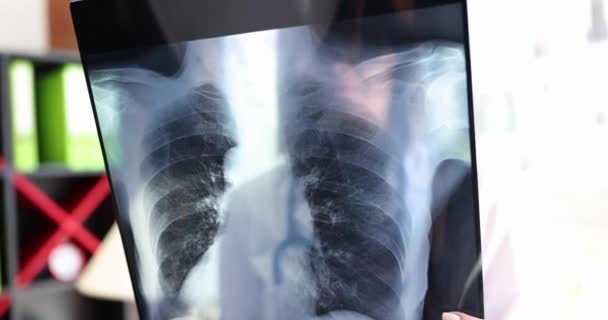 Médico Con Una Radiografía Las Manos Primer Plano Diagnósticos Por — Vídeo de stock