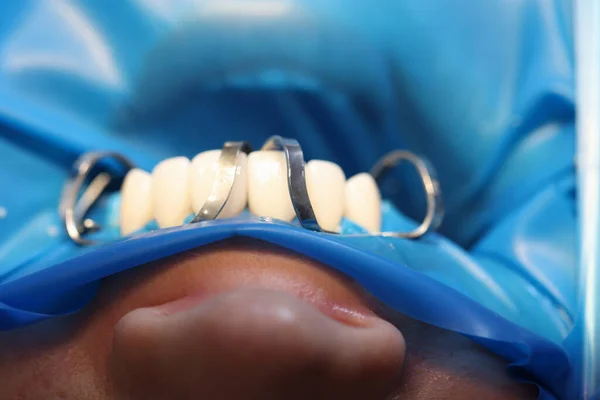 Οδοντίατρος Οδοντιατρική Περίθαλψη Έννοια Μπλε Φόντο — Φωτογραφία Αρχείου