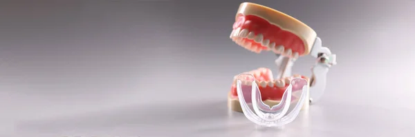 Nahaufnahme Des Zahnmodells Und Der Richtzähne Kieferorthopädisches Zahnmodell Oder Menschlicher — Stockfoto