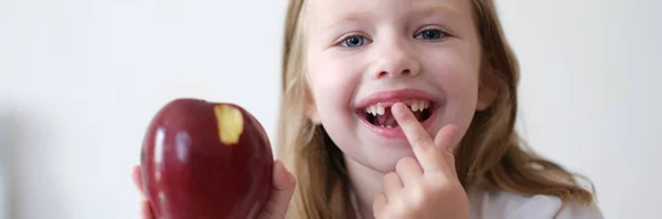 치아가없는 즐거운 소녀의 모습에는 사과가 젖니의 변화와 음식의 — 스톡 사진