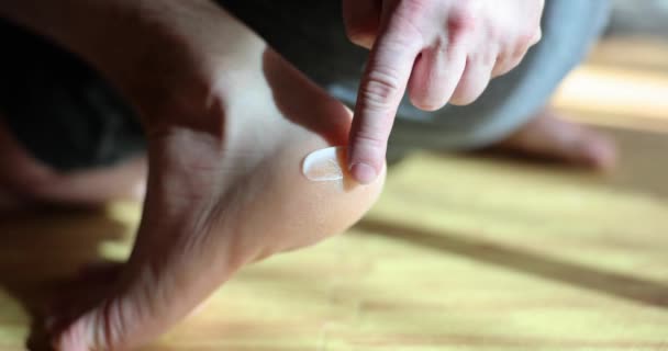 Man Rubbing Rough Dry Skin Feet Moisturizing Cream Closeup Movie — Stock Video