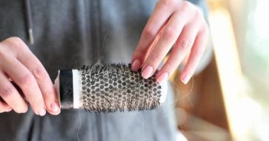 Kadın elinde tarakla saçlarını kaybediyor. Dişi kellik ve tedavi