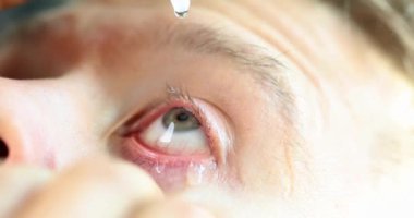 Göz damlası damlayan bir adamın yakınlaşması gözleri nemlendirir. Kuru göz sendromundan muzdarip tıbbi göz damlası kullanıyor veya göz hastalıklarını tedavi ediyor.
