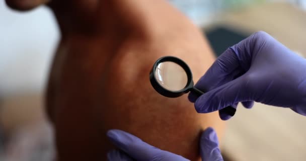Δερματολόγος Εξετάζει Δέρμα Μπαλώματα Του Ασθενούς Στενή Κλινική Κάψτε Τις — Αρχείο Βίντεο