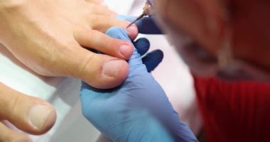 Manikür ustası mavi eldivenli, yakın plan bir kadın pedikür yapıyor. Parmaklardaki burrlar kaldırılıyor