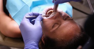 Klinikteki diş tedavisinde ağzı açık bir kadın, yakın plan, ön görüş. Ultrasonik diş fırçalama