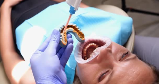 歯医者と口を開いている女性は クローズアップ 城のキャスト ブレースのインストール スローモーション — ストック動画
