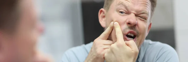 Portrait Man Squeeze Get Rid Pimple Face Looking Mirror Male — Fotografia de Stock