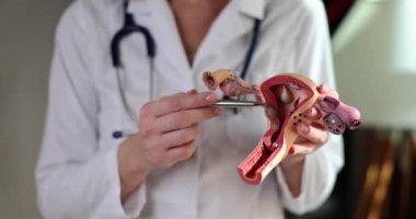 Jinekolog rahmin ve yumurtalıkların plastik modeline yakından bakıyor. Kadın üreme sisteminin hastalıkları ve tedavisi