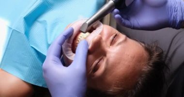 Diş hekimi dişlerin üzerindeki dişi kaplamaları ve seramik kaplamaları diş kliniğinde ultraviyole lambayla tamir ediyor. Diş Hizmetleri